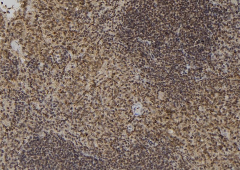 Polyclonal Rabbit anti-Human XRCC2 Antibody (IHC, WB)