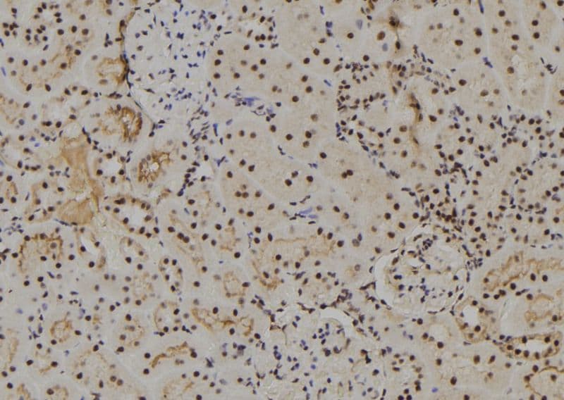 SNARK / NUAK2 Antibody