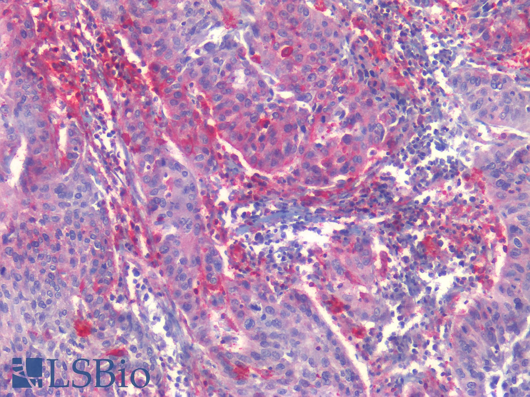 PathPlus™ Polyclonal Rabbit anti-Human EPHB2 / EPH Receptor B2 Antibody (C-Terminus, IHC)