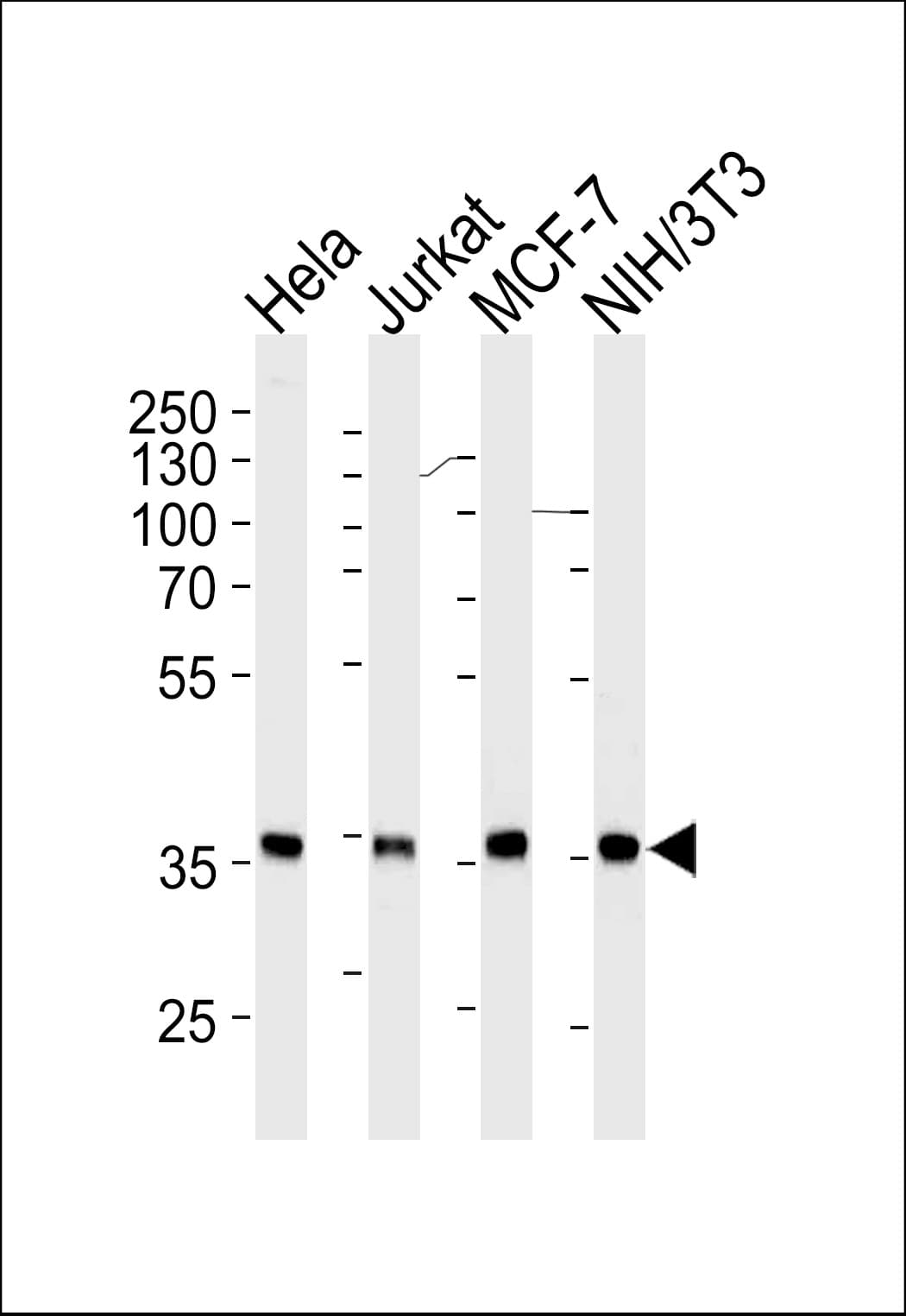 NPM1 / NPM / Nucleophosmin Antibody (clone 1042CT5.2.1)