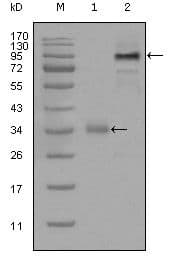 ER81 / ETV1 Antibody (Amino Acid: 1-191, clone 1C8B6)