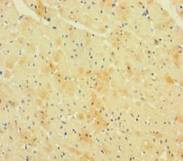 Polyclonal Rabbit anti-Human RCAN1 / DSCR1 Antibody