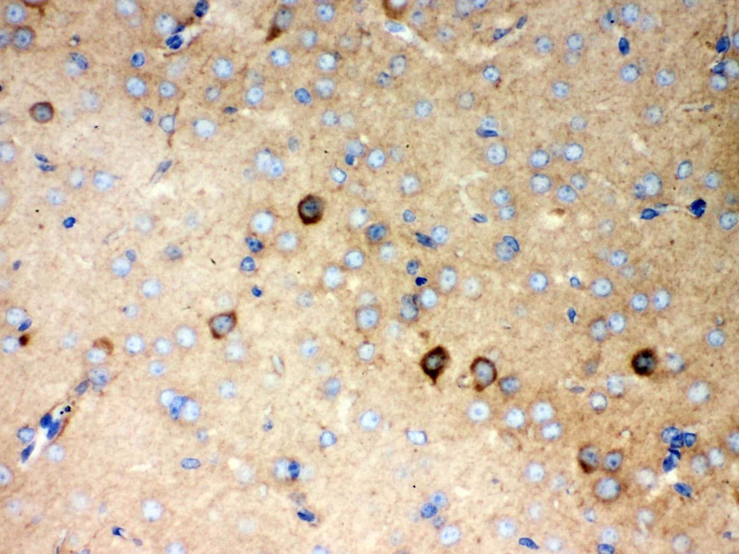Polyclonal Rabbit anti-Human P2RX5 / P2X5 Antibody (aa333-422, IHC, WB)
