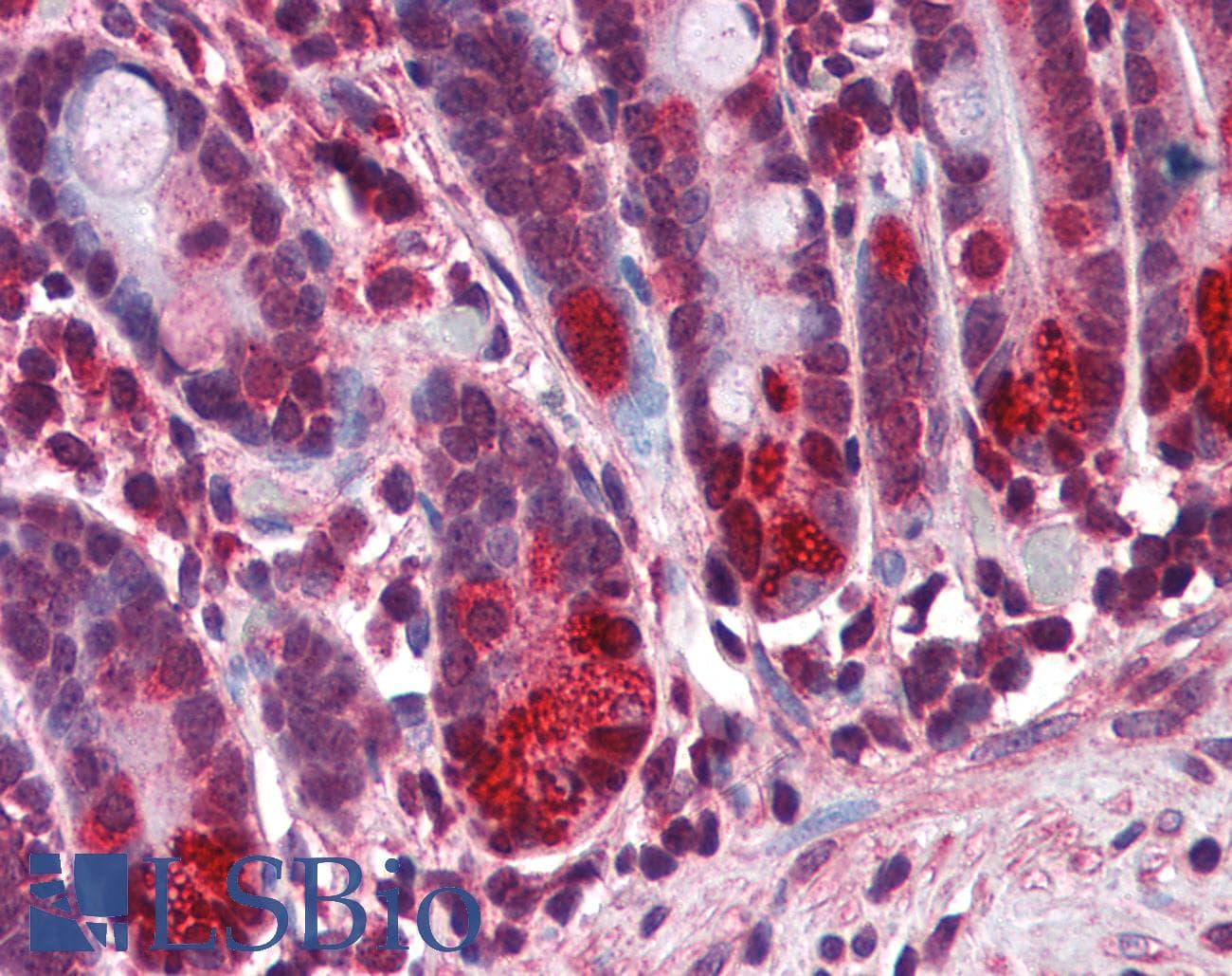IHC-plus™ NOD2 / CARD15 Antibody