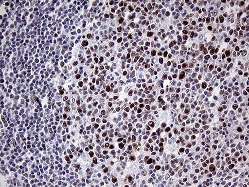 Monoclonal Mouse anti-Human MLH1 Antibody (clone OTI3C1, Carrier-free, aa299-527, IHC, WB)