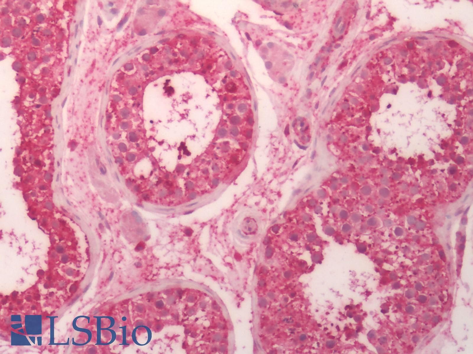PathPlus™ CRFR1 / CRHR1 Antibody (N-Terminus)