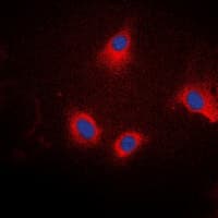 Polyclonal Rabbit anti-Human Ezrin + Radixin + Moesin Antibody (phospho-Thr567/Thr564/Thr558, IHC, IF, WB)