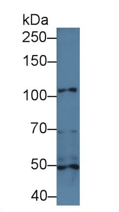 ITGA3 / CD49c Antibody (aa33-236, APC)