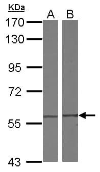 CCT4 / SRB Antibody