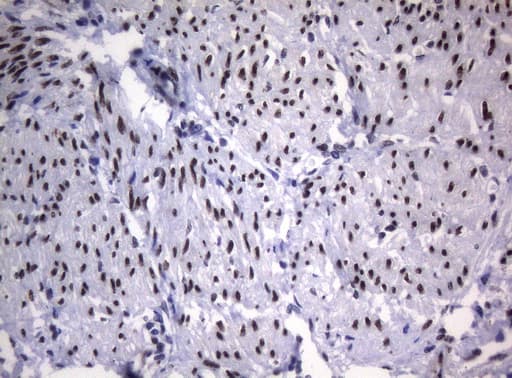 Monoclonal Mouse anti-Human SAMD12 Antibody (clone OTI2G1, IHC, WB)