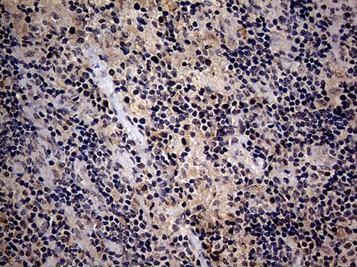 ITGB1 / Integrin Beta 1 / CD29 Antibody (clone OTI9B5)