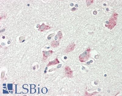 IHC-plus™ PCDHA3 Antibody (aa773-800)