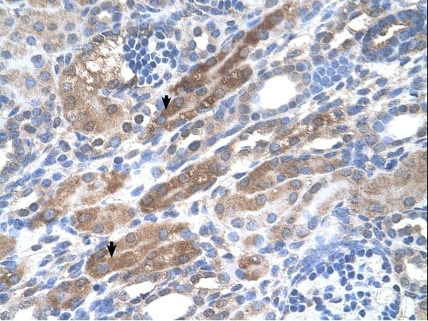 Polyclonal Rabbit anti-Human KIAA0319 Antibody (aa151-200, IHC, WB)