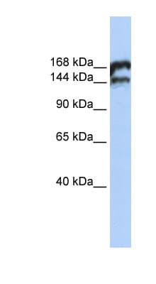 Polyclonal Rabbit anti-Human TOP2B / Topoisomerase II Beta Antibody (aa1548-1597, WB)