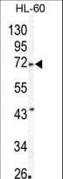 MMP24 Antibody (aa396-425)
