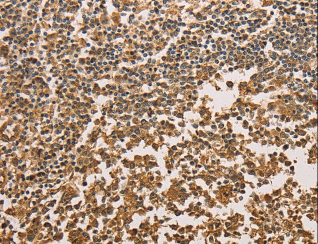 SETD2 Antibody
