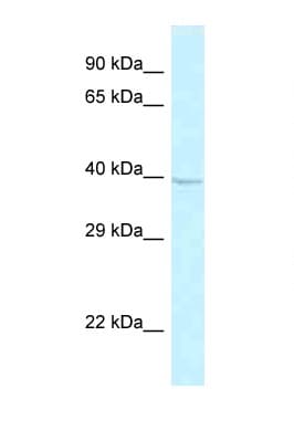 Polyclonal Rabbit anti-Human GPR174 Antibody (aa214-263, WB)
