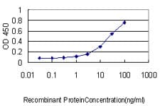 IHC-plus™ CCT5 / TCP1 Epsilon Antibody (clone 4E5-4B1)