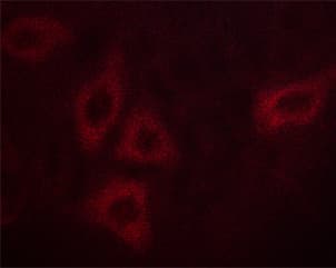 Polyclonal Rabbit anti-Human CALM3 / Calmodulin 3 Antibody (phospho-Thr79,phospho-Ser81, IHC, IF, WB)