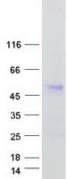 Human ANKRD10 Protein (Recombinant Myc-DDK (Flag))
