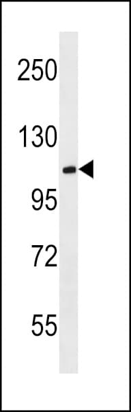 Polyclonal Rabbit anti-Human MBD6 Antibody (aa977-1003, WB)