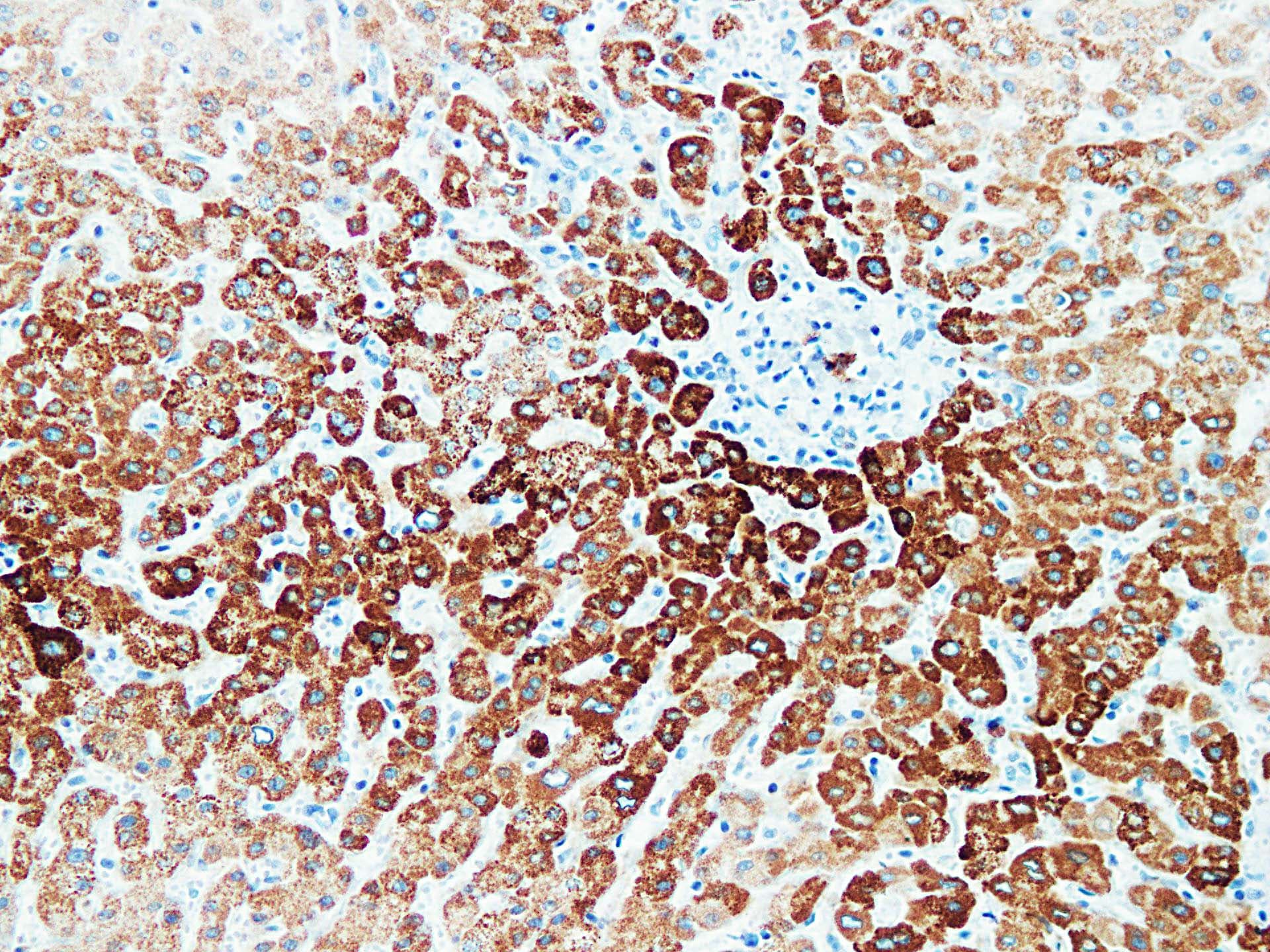 VHL / Von Hippel Lindau Antibody (clone ABT-PVHL)