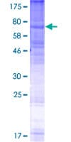 Human GPR143 Protein (Recombinant GST)
