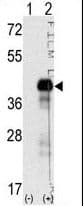 Polyclonal Rabbit anti-Human SOX2 Antibody (aa89-119, IHC, IF, WB)