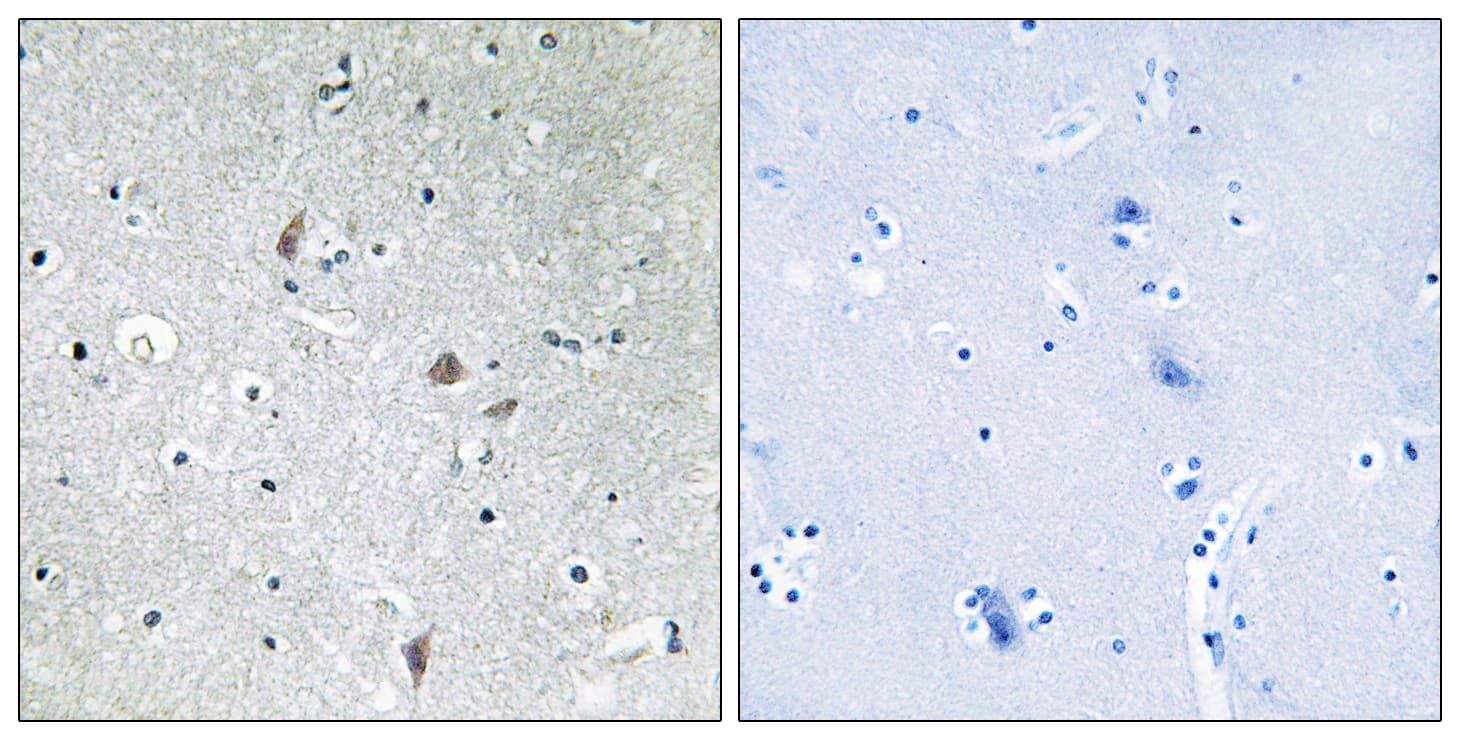 Polyclonal Rabbit anti-Human MTOR Antibody (phospho-Ser2448, IHC, WB)