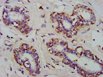 Polyclonal Rabbit anti-Human ARFRP1 Antibody (IHC)