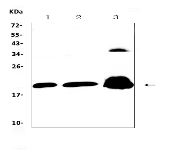 PPP1R14A / CPI-17 Antibody