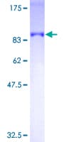 Human OPTN / Optineurin Protein (Recombinant GST)