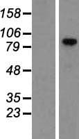 VCAM1 / CD106 Protein (Over-Expression Lysate Myc-DDK (Flag))