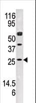 AK4 / Adenylate Kinase 4 Antibody (aa23-53)