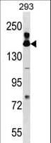 FANCA Antibody (aa667-694)