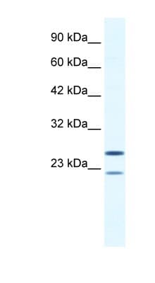 Polyclonal Rabbit anti-Human TRIM14 Antibody (aa116-165, IHC, WB)