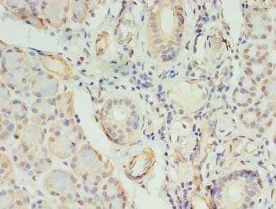 COPB1 / Beta-COP Antibody