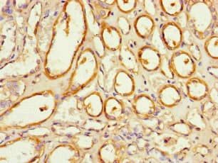 Polyclonal Rabbit anti-Human NOXA1 Antibody (IHC, IF, WB)