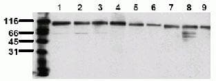 TOP1 / Topoisomerase I Antibody (aa699-725, clone 23B11)
