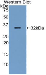 FLNB / TAP Antibody (aa1175-1457, Cy3)
