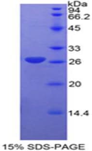 Bovine CCND1 / Cyclin D1 Protein (Recombinant His-T7)
