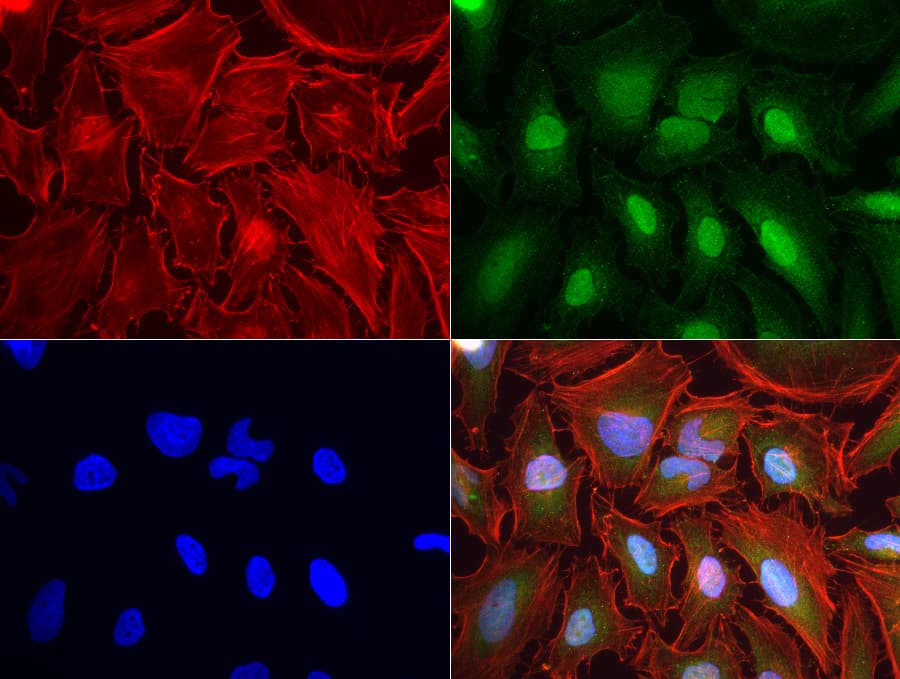 MSMB / MSP Antibody (clone UMAB148, Carrier-free)