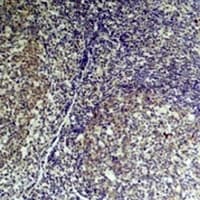TNF Alpha Antibody