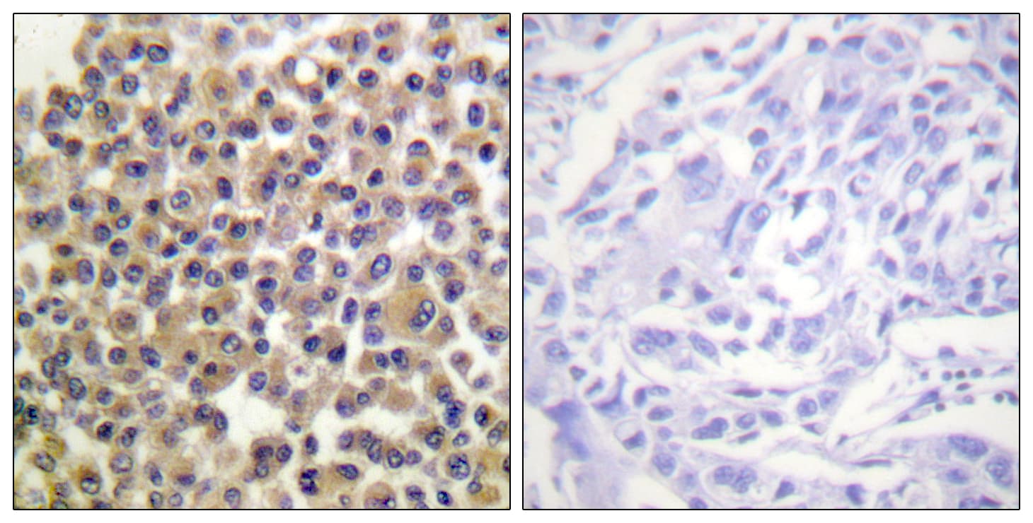 BCAR1 / p130Cas Antibody (phospho-Tyr249)