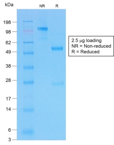 CFTR Antibody (aa 258-385, clone CFTR/1775R)