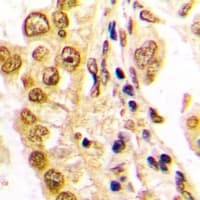 Polyclonal Rabbit anti-Human AP-1 / JUND Antibody (C-Terminus, IHC, WB)