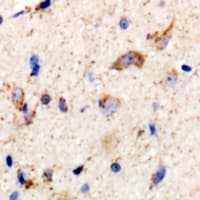 Polyclonal Rabbit anti-Human LRP1 / CD91 Antibody (IHC, WB)