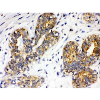 ITGA4 / VLA-4 / CD49d Antibody (aa999-1028)
