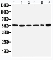 Polyclonal Rabbit anti-Human SCLY Antibody (aa432-445, WB)