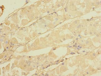 CALHM3 Antibody